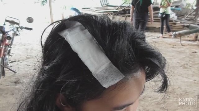 นักเรียน ม.6.ใจเด็ด!ถูกคนร้ายใช้คมแฝกตีหัว หวิดถูกข่มขืน ฮึดสู้จนรอดมาได้