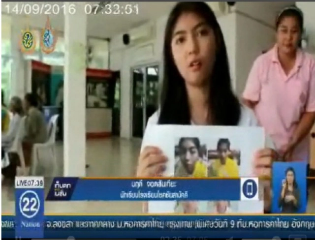 เปิดใจ "น้องทราย" นร.ถูกครูพละปาแก้วจนปากเบี้ยว