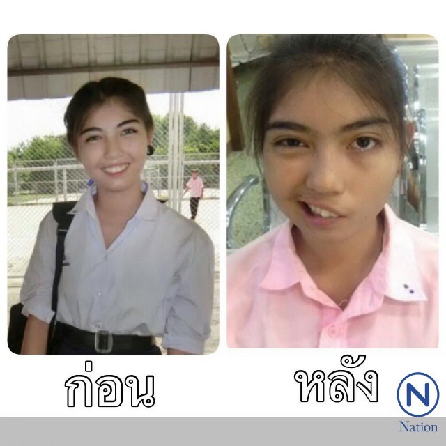 "ปวีณา"พาสาว ม.5 
พบหมอเฉพาะทางยันฮี
เริ่มรักษาอาการ"ปากเบี้ยว"