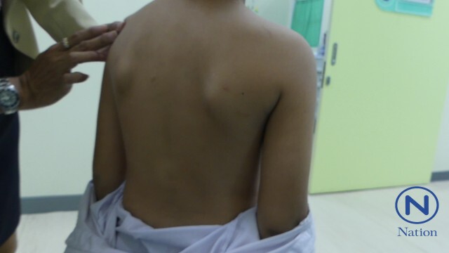 ครูสุดทน!
พาเด็ก 7 ขวบ ร้อง ศูนย์ฯรพ.ปทุมช่วย
ถูก"ทอม"แฟนใหม่แม่ 
ใช้ไม้เรียว-ไม้แขวน-เท้าถีบจนช้ำ