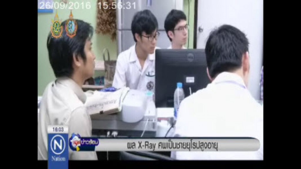 ผล X-Rey ศพเป็นชายยุโรปสูงอายุ