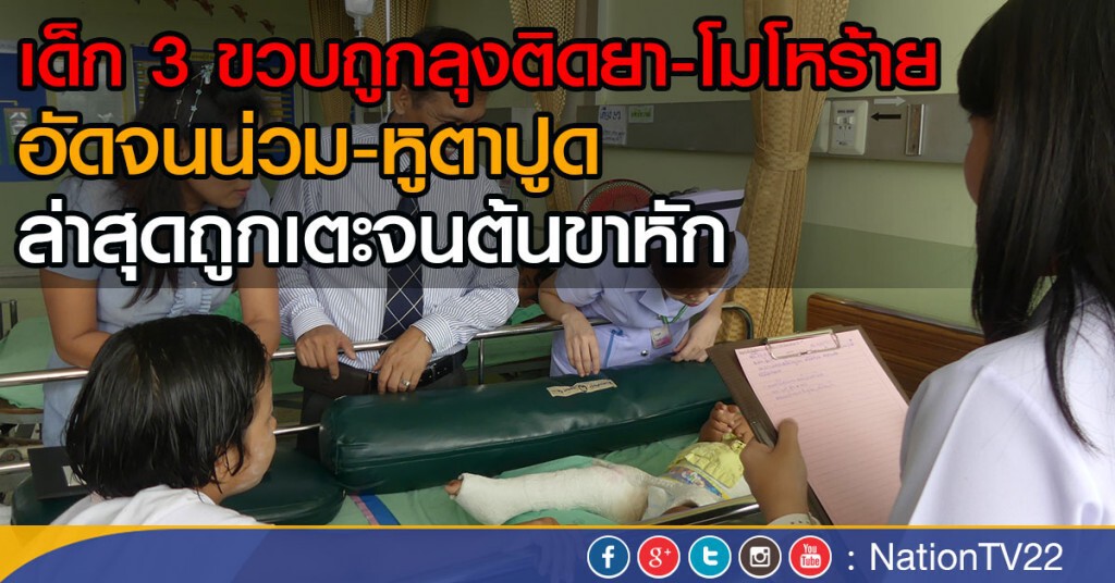 เด็ก 3 ขวบถูกลุงติดยา-โมโหร้าย
อัดจนน่วม-หูตาปูด
ล่าสุดถูกเตะจนต้นขาหัก