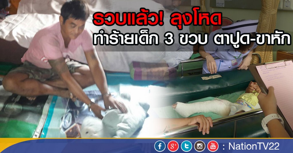 รวบแล้ว!
ลุงโหดเตะ เด็ก 3 ขวบ ขาหัก