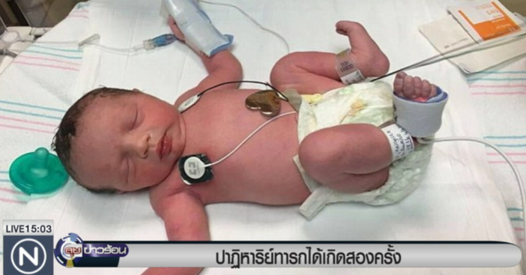 ปาฏิหารย์ทารกในสหรัฐเกิดสองครั้ง ปาฏิหารย์ทารกในสหรัฐเกิดสองครั้ง