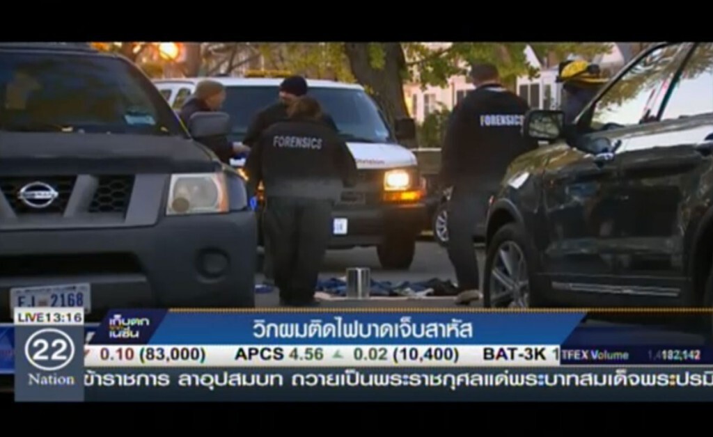 วิกผมติดไฟบาดเจ็บสาหัส