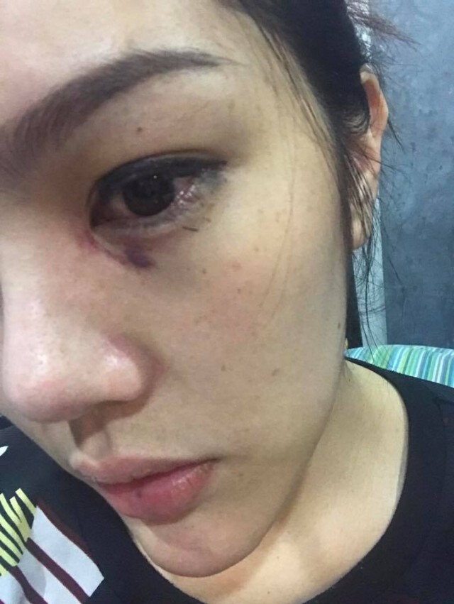 รองมิสทิฟฟานี่ 2016โร่แจ้งความ
ถูกคนดูแลหอพักรุมทำร้ายหลังทะเลาะผ่านไลน์เรื่องขอย้ายออก
