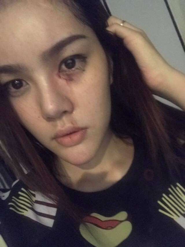 รองมิสทิฟฟานี่ 2016โร่แจ้งความ
ถูกคนดูแลหอพักรุมทำร้ายหลังทะเลาะผ่านไลน์เรื่องขอย้ายออก