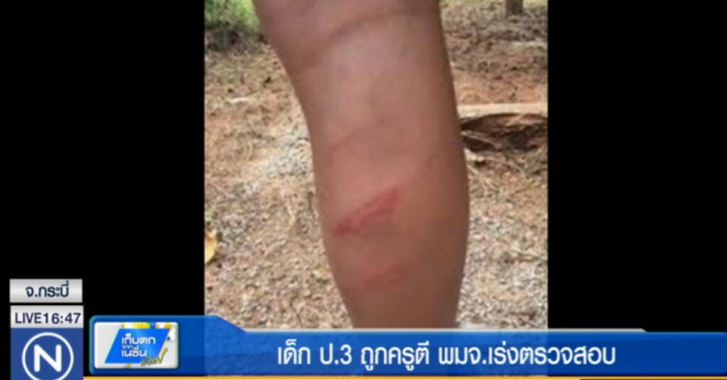 แชร์กระหน่ำโลกออนไลน์ เด็ก ป.3 ถูกครูตี พมจ.เร่งตรวจสอบ
