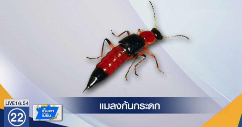 "แมลงก้นกระดก" อาละวาด แค่โดนจะเป็นแผลพุพอง "แมลงก้นกระดก" อาละวาด แค่โดนจะเป็นแผลพุพอง