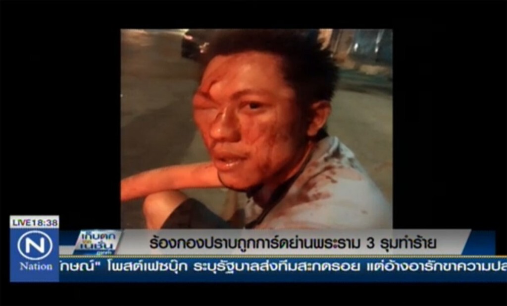 ร้องกองปราบถูกการ์ดย่านพระราม 3 รุมทำร้าย