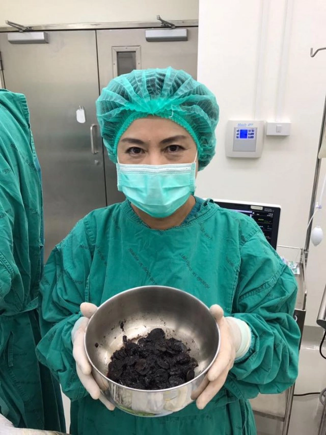 เปิดภาพจากห้องผ่าตัด... จากใจทีมแพทย์ผู้ช่วยชีวิต"เจ้าออมสิน"