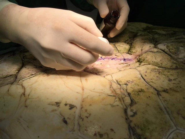 เปิดภาพจากห้องผ่าตัด... จากใจทีมแพทย์ผู้ช่วยชีวิต"เจ้าออมสิน"