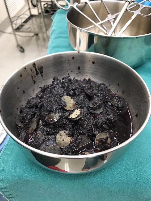 เปิดภาพจากห้องผ่าตัด... จากใจทีมแพทย์ผู้ช่วยชีวิต"เจ้าออมสิน"