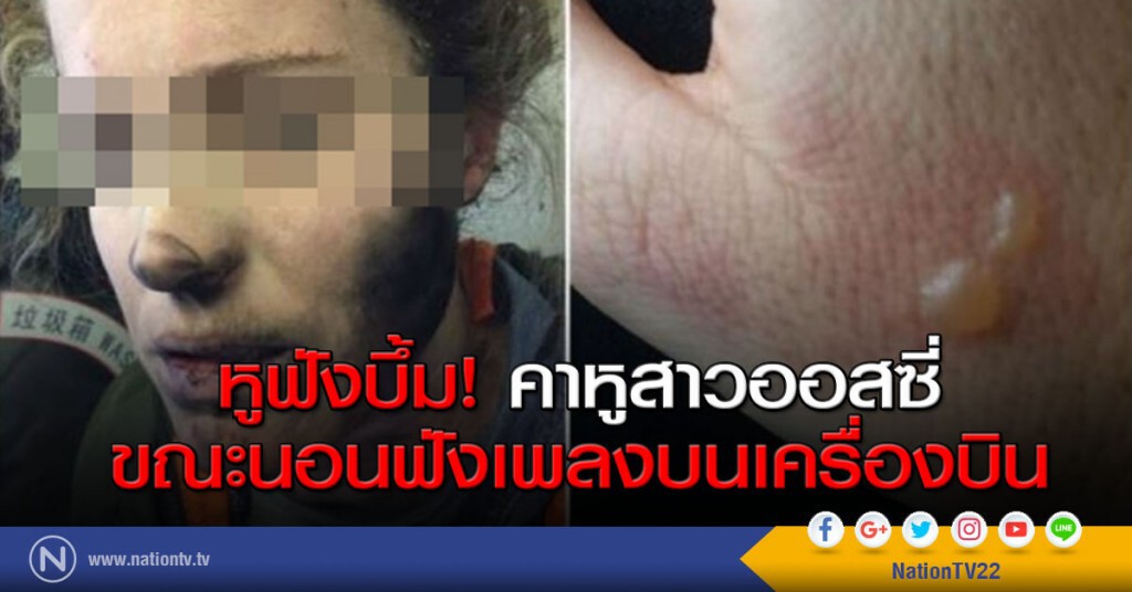 หูฟังบึ้ม! คาหูสาวออสซี่ขณะนอนฟังเพลงบนเครื่องบิน หูฟังบึ้ม! คาหูสาวออสซี่ขณะนอนฟังเพลงบนเครื่องบิน