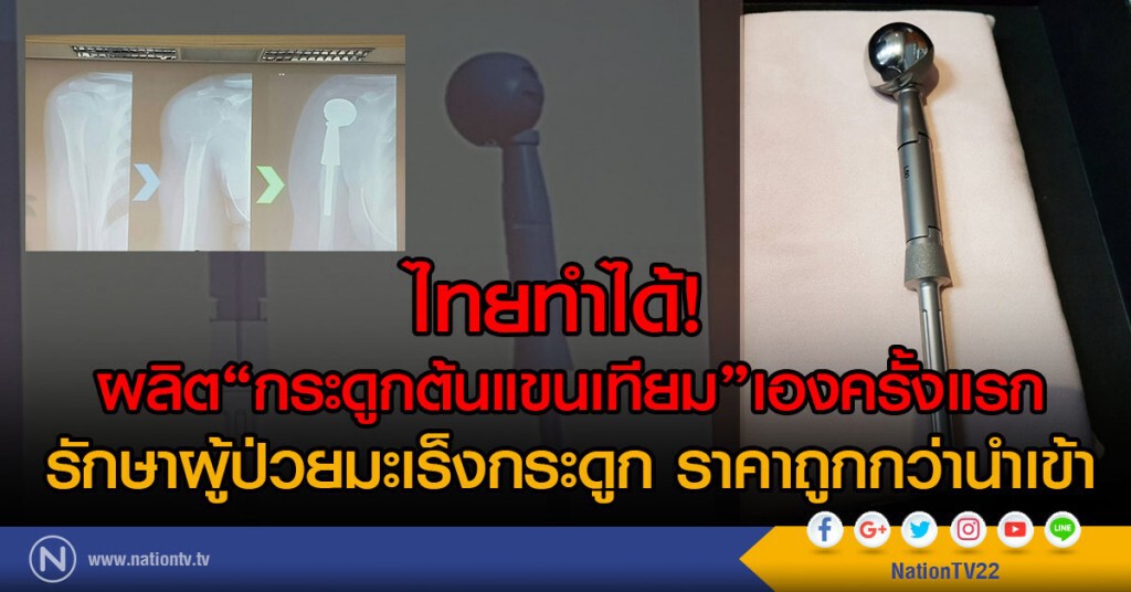 ไทยทำได้!
ผลิต"กระดูกต้นแขนเทียม"เองครั้งแรก
รักษาผู้ป่วยมะเร็งกระดูก ราคาถูกกว่านำเข้า ไทยทำได้!
ผลิต"กระดูกต้นแขนเทียม"เองครั้งแรก
รักษาผู้ป่วยมะเร็งกระดูก ราคาถูกกว่านำเข้า