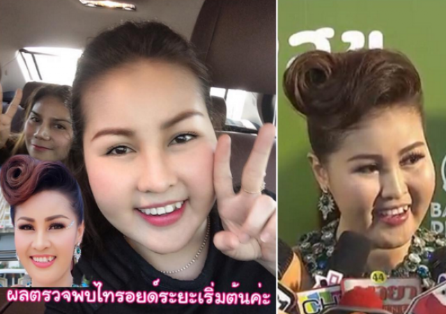ลูกทุ่งสาว หญิงลี แจงมีอาการไทรอยด์ผิดปกติ  หลังหน้าบวมกล้ามเนื้ออ่อนแรง
