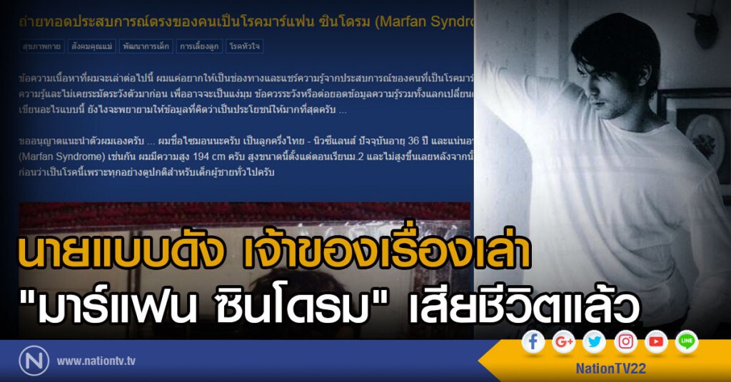 "ไซมอน คิว แฮร์ริส" นายแบบดัง เจ้าของเรื่องเล่าผู้มีอาการมาร์แฟนซินโดรม ตัวสูงผิดปกติ เสียชีวิตแล้ว