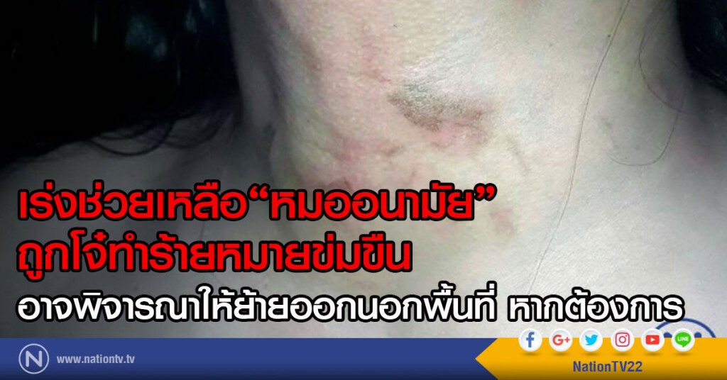 เร่งช่วยเหลือ"หมออนามัย"
ถูกโจ๋ทำร้ายหมายข่มขืน
อาจพิจารณาให้ย้ายออกนอกพื้นที่ หากต้องการ