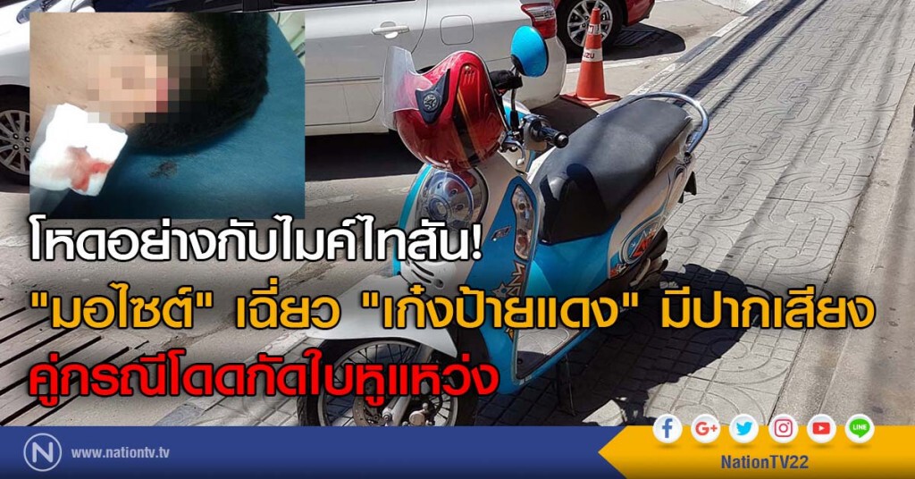 โหดอย่างกับไมค์ไทสัน! "มอไซต์" เฉี่ยว "เก๋งป้ายแดง" มีปากเสียง คู่กรณีโดดกัดใบหูแหว่ง