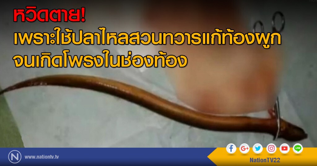 หวิดตาย!
เพราะใช้ปลาไหลสวนทวารแก้ท้องผูก
จนเกิดโพรงในช่องท้อง หวิดตาย!
เพราะใช้ปลาไหลสวนทวารแก้ท้องผูก
จนเกิดโพรงในช่องท้อง