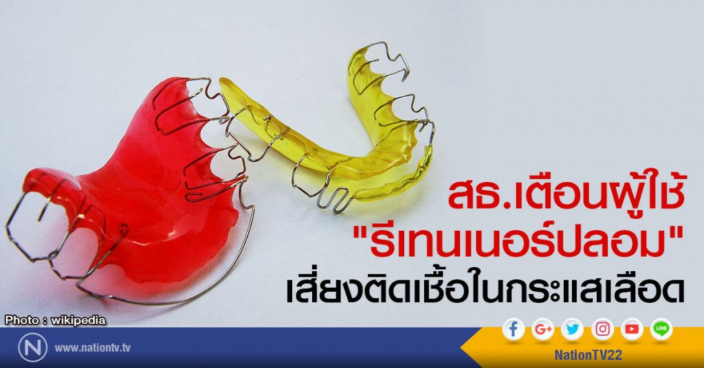 สธ.เตือนผู้ใช้"รีเทนเนอร์ปลอม"
เสี่ยงติดเชื้อในกระแสเลือด