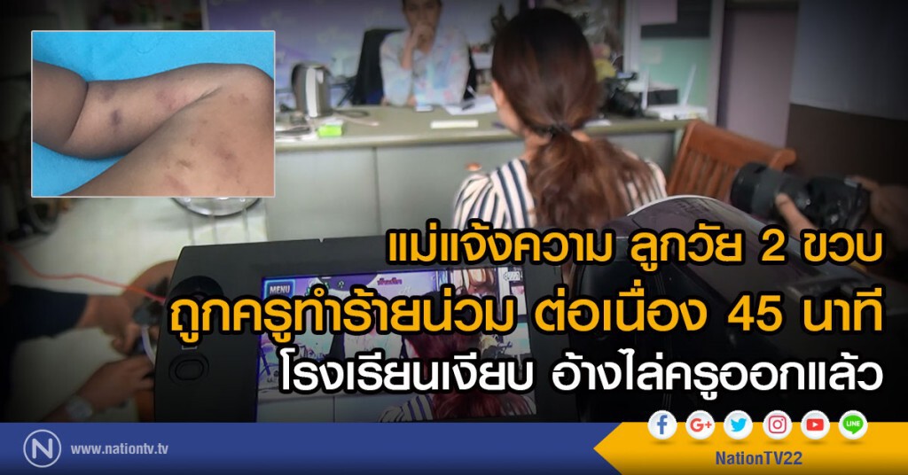 แม่แจ้งความ ลูกวัย 2 ขวบ
ถูกครูทำร้ายน่วม ต่อเนื่อง 45 นาที
โรงเรียนเงียบ อ้างไล่ครูออกแล้ว