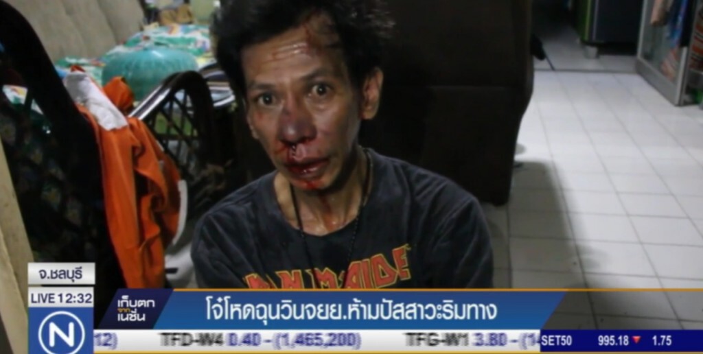 กลุ่มวัยรุ่นโหด รุมฟันวิน จยย.บังอาจห้าม "เยี่ยว" ริมถนน