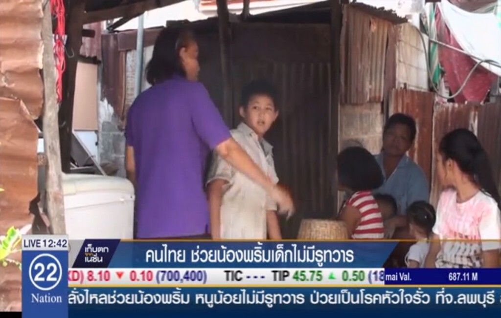คนไทยช่วยน้องพริ้ม เด็กไม่มีรูทวาร คนไทยช่วยน้องพริ้ม เด็กไม่มีรูทวาร