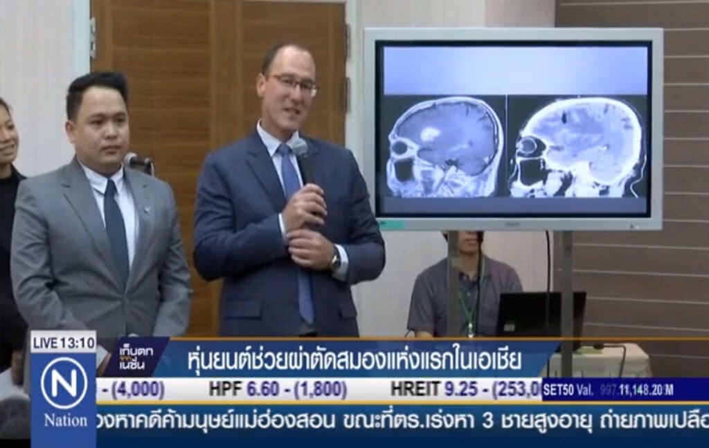 หุ่นยนต์ช่วยผ่าตัดสมอง แห่งแรกในเอเชีย หุ่นยนต์ช่วยผ่าตัดสมอง แห่งแรกในเอเชีย