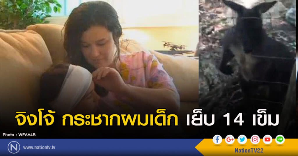 จิงโจ้ กระชากผมเด็ก เย็บ 14 เข็ม จิงโจ้ กระชากผมเด็ก เย็บ 14 เข็ม