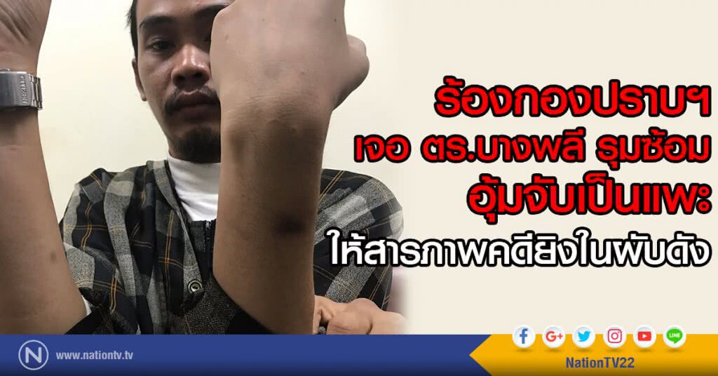ร้องกองปราบฯ  
เจอ ตร.บางพลี รุมซ้อม
อุ้มจับเป็นแพะ
ให้สารภาพคดียิงในผับดัง