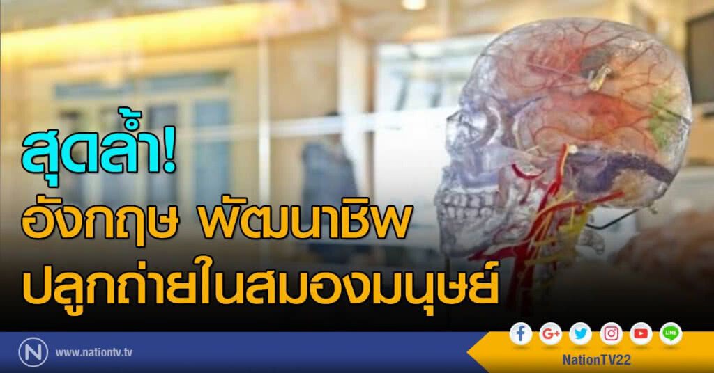 สุดล้ำ! อังกฤษพัฒนาชิพปลูกถ่ายในสมองมนุษย์ สุดล้ำ! อังกฤษพัฒนาชิพปลูกถ่ายในสมองมนุษย์