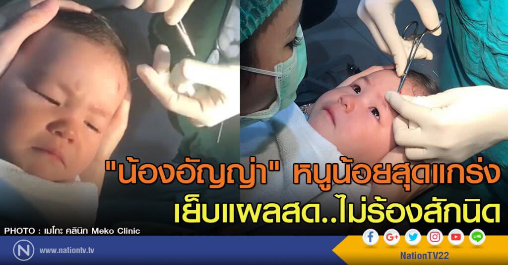 น้องอัญญ่า" หนูน้อยสุดแกร่ง
เย็บแผลสด..ไม่ร้องสักนิด