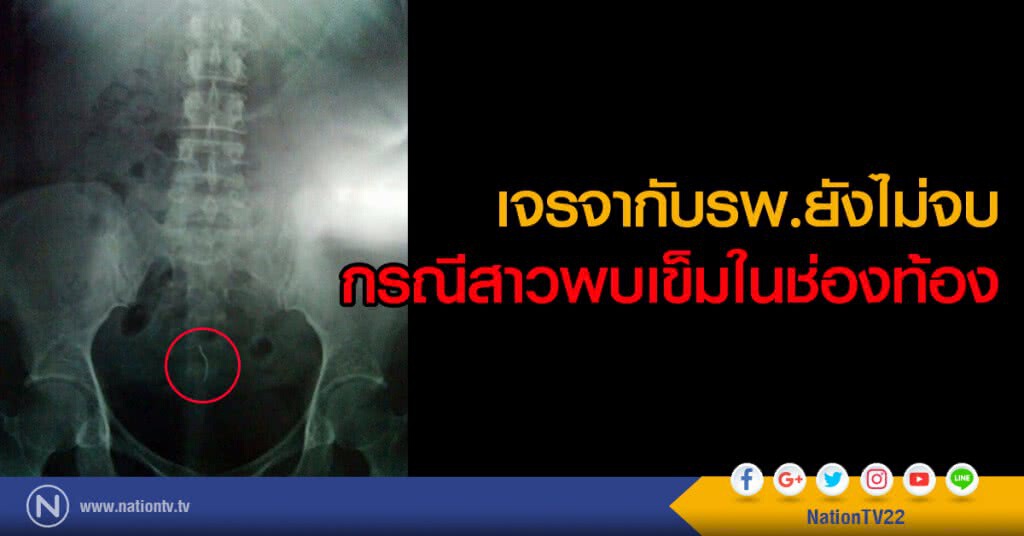 เจรจากับรพ.ยังไม่จบ
กรณีสาวพบเข็มในช่องท้อง