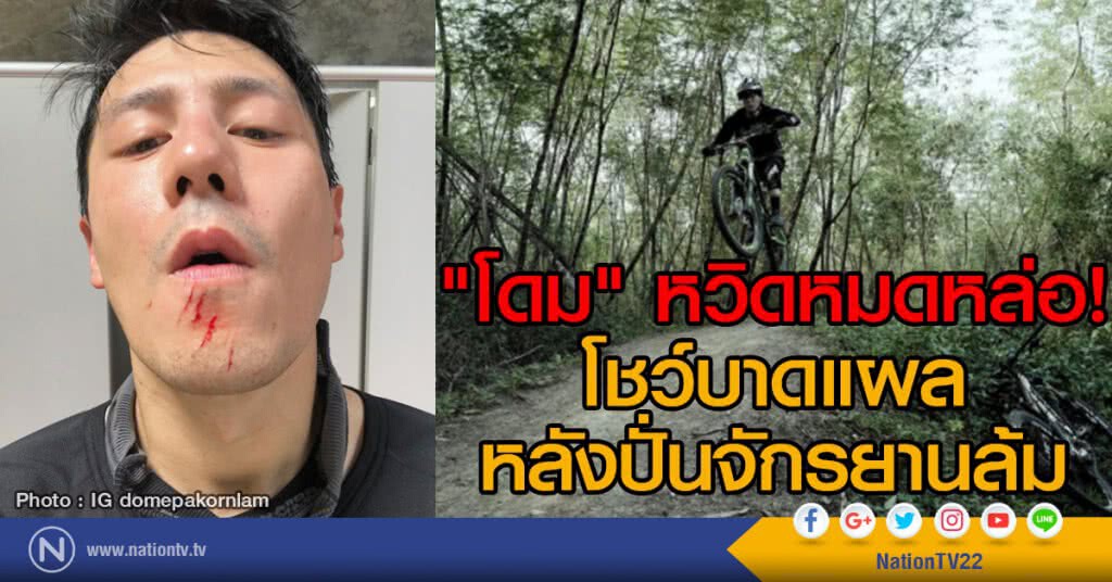 "โดม" หวิดหมดหล่อ!
โชว์บาดแผล หลังปั่นจักรยานล้ม "โดม" หวิดหมดหล่อ!
โชว์บาดแผล หลังปั่นจักรยานล้ม