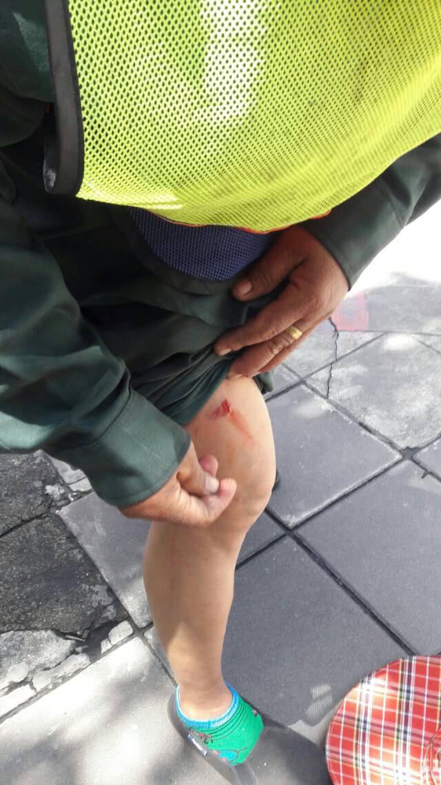 ด่วน! เกิดเหตุระเบิดในซอยสุขุมวิท 40 หญิงเจ็บ 1 ราย