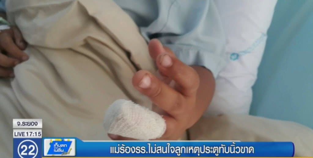 แม่ร้องโรงเรียนไม่สนใจ เพื่อนปิดประตูทับนิ้วลูกขาด แม่ร้องโรงเรียนไม่สนใจ เพื่อนปิดประตูทับนิ้วลูกขาด