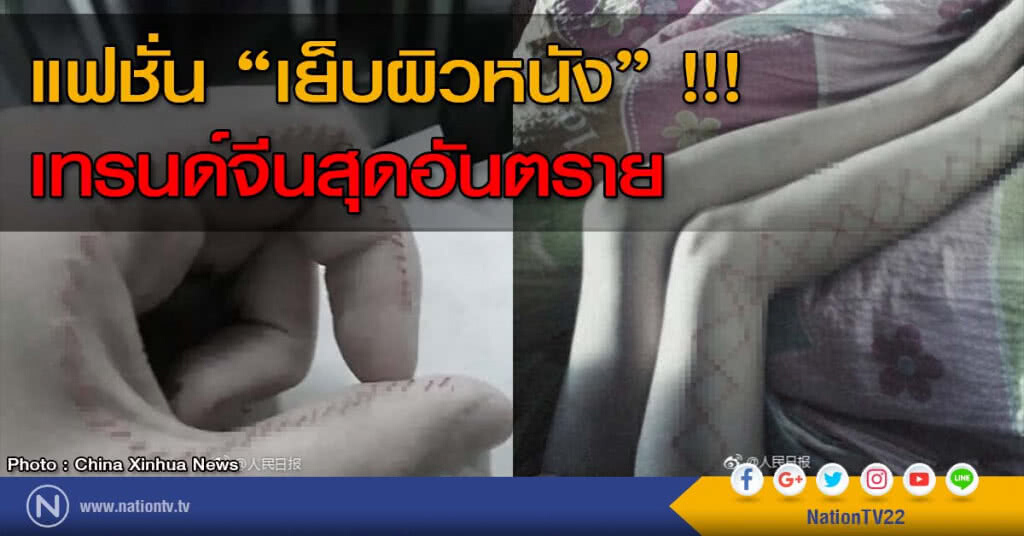 แฟชั่น "เย็บผิวหนัง" !!! เทรนด์จีนสุดอันตราย แฟชั่น "เย็บผิวหนัง" !!! เทรนด์จีนสุดอันตราย