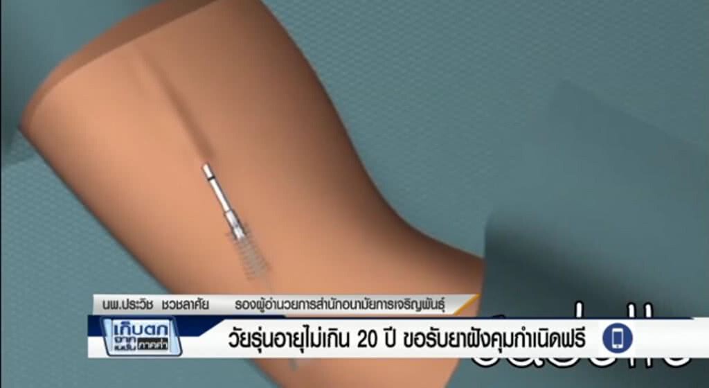 เก็บตกจากเนชั่นภาคค่ำ : วัยรุ่นอายุไม่เกิน20ปี ขอรับยาฝังคุมกำเนิดฟรี | ช่วงที่ 1/3 | 23-06-60 เก็บตกจากเนชั่นภาคค่ำ : วัยรุ่นอายุไม่เกิน20ปี ขอรับยาฝังคุมกำเนิดฟรี | ช่วงที่ 1/3 | 23-06-60
