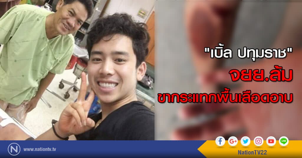 "เบิ้ล ปทุมราช" จยย.ล้ม ขากระแทกพื้นเลือดอาบ "เบิ้ล ปทุมราช" จยย.ล้ม ขากระแทกพื้นเลือดอาบ