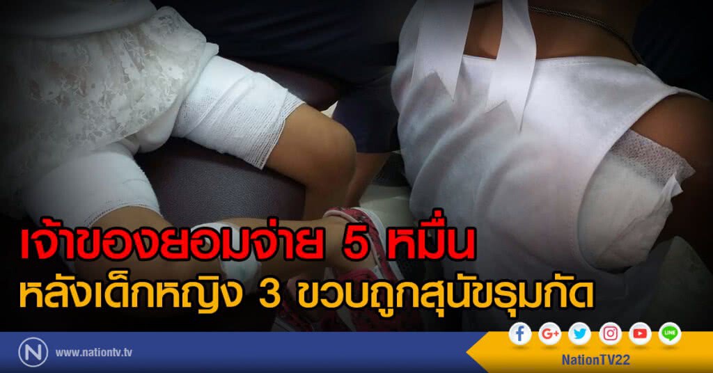 เจ้าของยอมจ่าย 5 หมื่น
หลังเด็กหญิง 3 ขวบถูกสุนัขรุมกัด