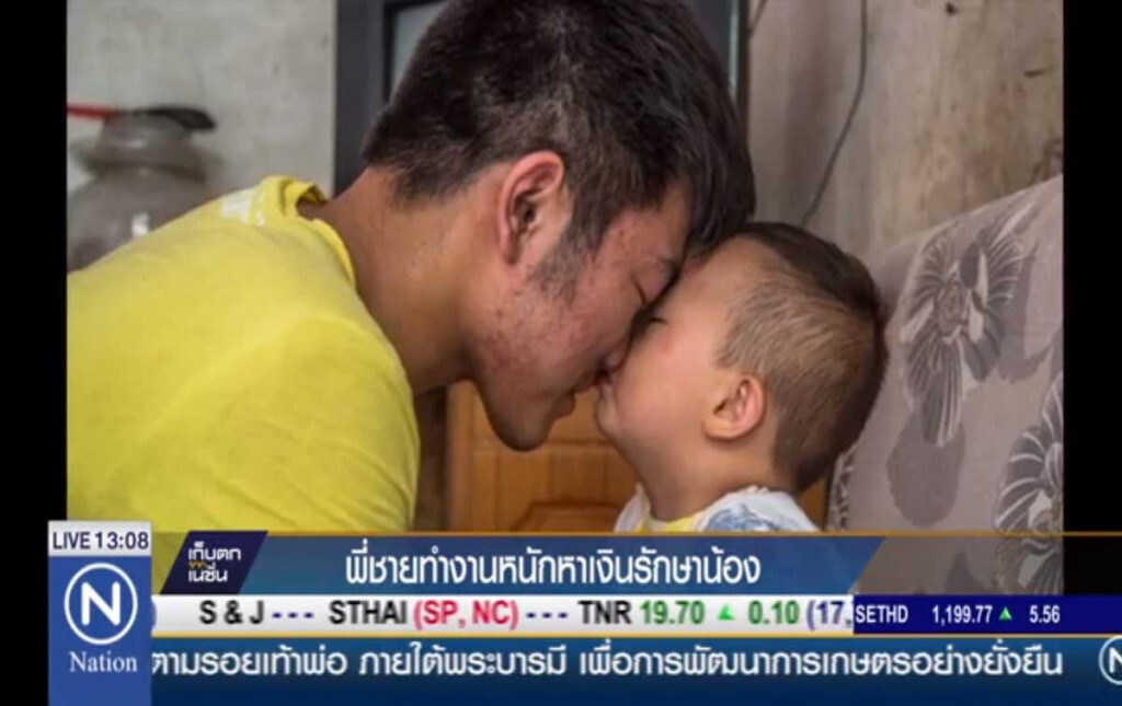 พี่ชายทำงานหนักหาเงินรักษาน้องปวยลูคีเมีย