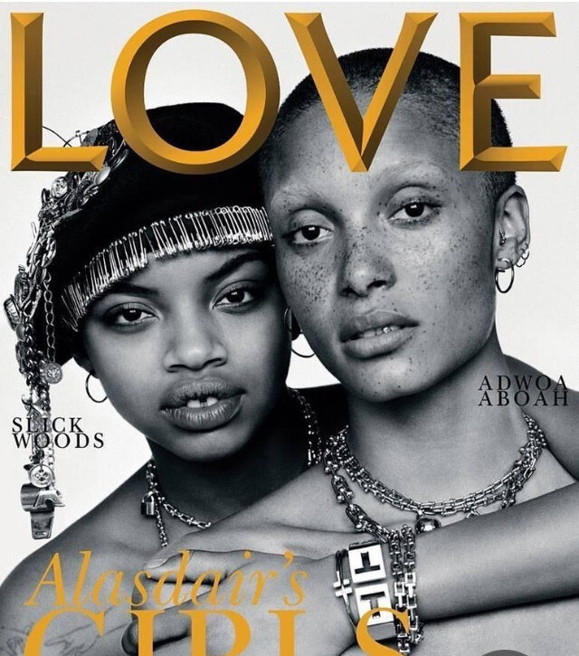 Slick Woods ขวัญใจ "ฟันห่าง" คนใหม่!