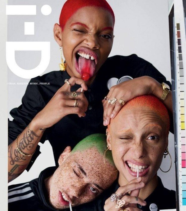 Slick Woods ขวัญใจ "ฟันห่าง" คนใหม่!