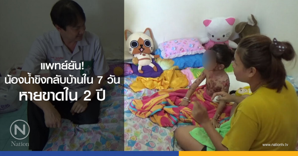 แพทย์ยัน
น้องน้ำขิงกลับบ้านใน 7 วัน
หายขาดใน 2 ปี