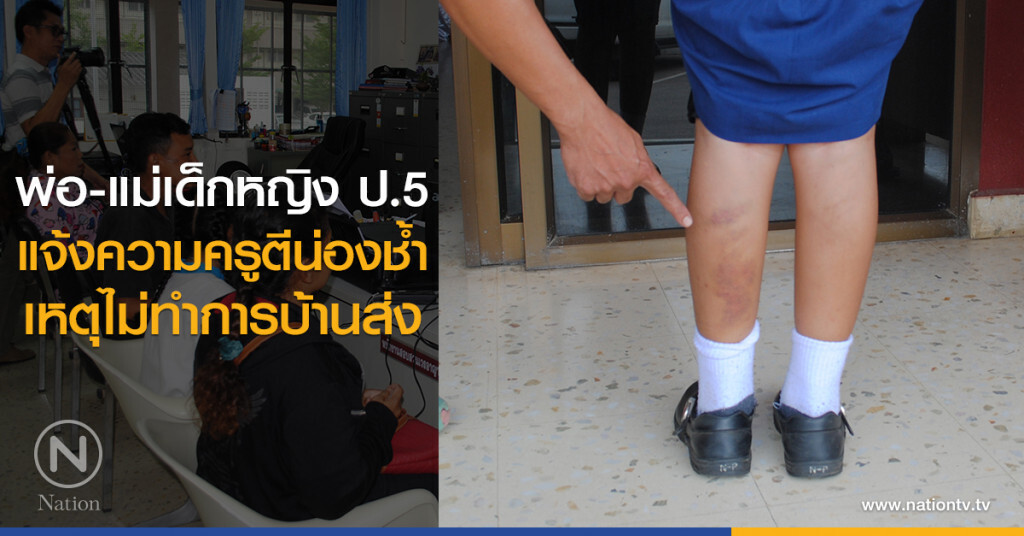 พ่อ-แม่เด็กหญิง ป.5
แจ้งความครูตีน่องช้ำ
เหตุไม่ทำการบ้านส่ง พ่อ-แม่เด็กหญิง ป.5
แจ้งความครูตีน่องช้ำ
เหตุไม่ทำการบ้านส่ง