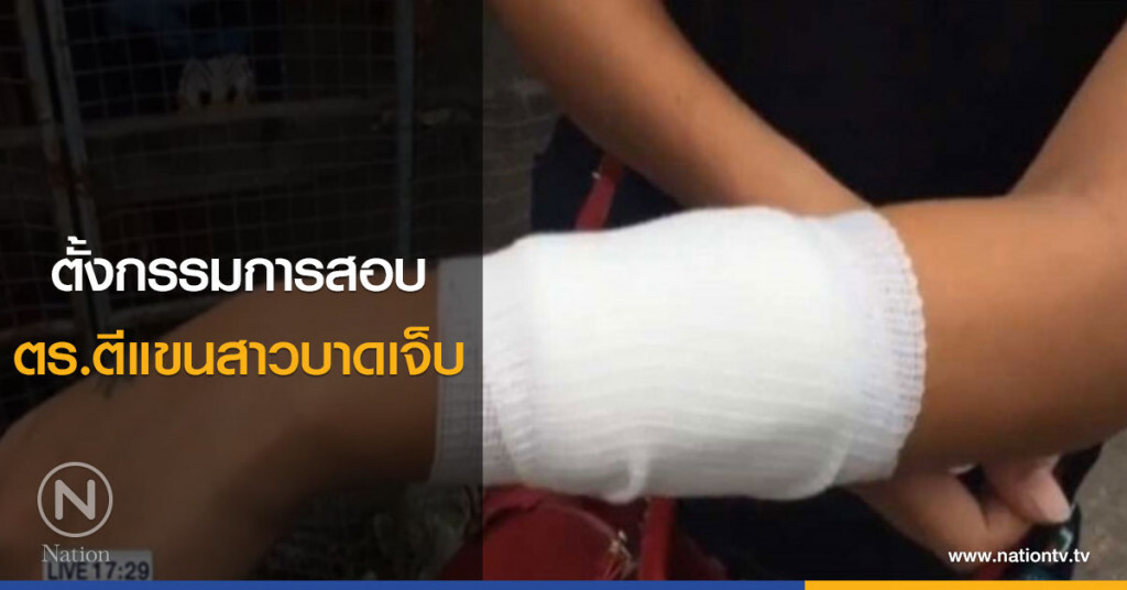 ตั้งกรรมการสอบ ตำรวจตีแขนสาวบาดเจ็บ ตั้งกรรมการสอบ ตำรวจตีแขนสาวบาดเจ็บ