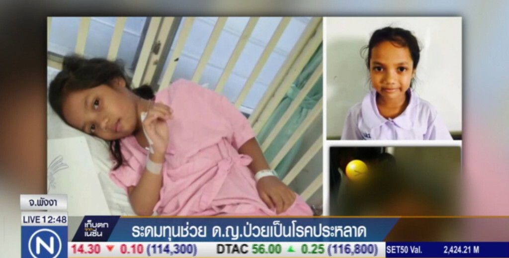ระดมทุนช่วย ด.ญ.ป่วยเป็นโรคประหลาด ระดมทุนช่วย ด.ญ.ป่วยเป็นโรคประหลาด