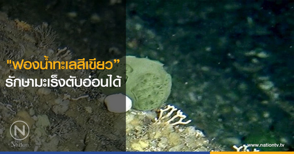 "ฟองน้ำทะเลสีเขียว" รักษามะเร็งตับอ่อนได้ "ฟองน้ำทะเลสีเขียว" รักษามะเร็งตับอ่อนได้