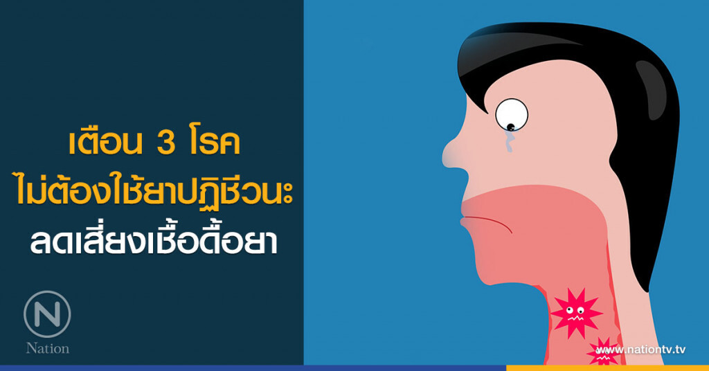 เตือน 3 โรคไม่ต้องใช้ยาปฏิชีวนะ ลดเสี่ยงเชื้อดื้อยา เตือน 3 โรคไม่ต้องใช้ยาปฏิชีวนะ ลดเสี่ยงเชื้อดื้อยา